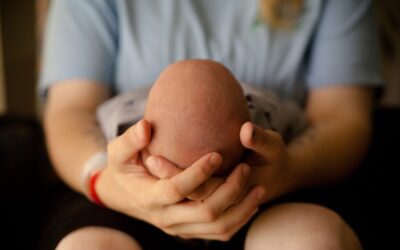 ¿Qué es la plagiocefalia?